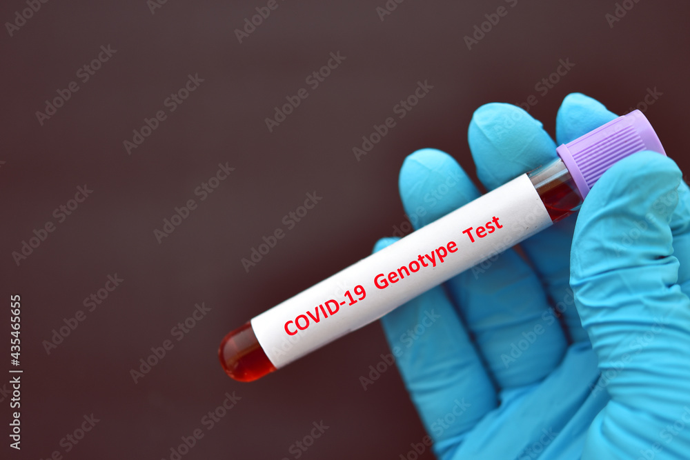 Obraz premium COVID-19 genotype test, blood sample tube for COVID-19 genotype test by using molecular method