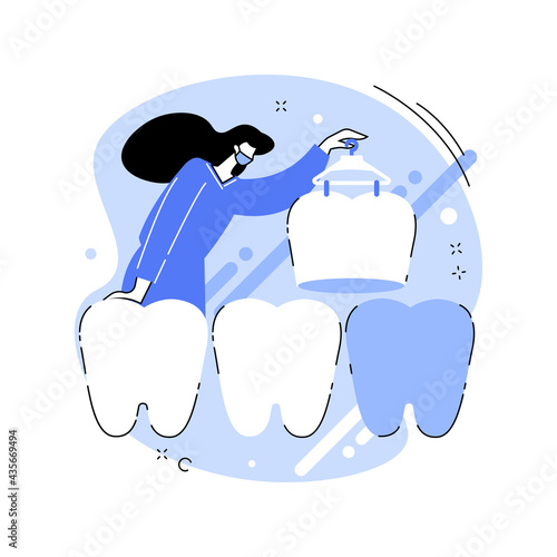 Dental veneers abstract concept vector illustration.