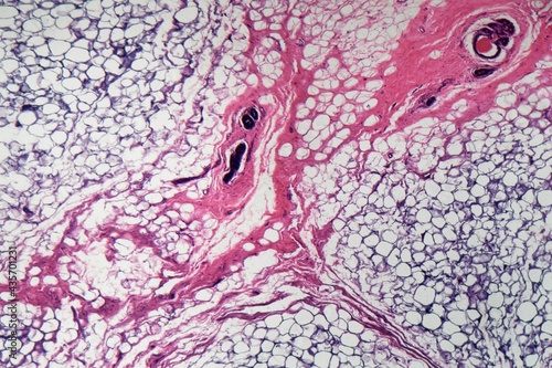 Human mammary gland cells under the microscope
