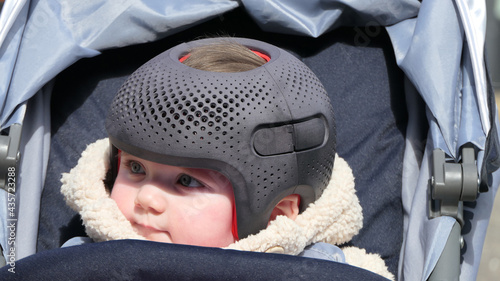 Baby girl wearing a cranial remoulding helmet flat head photo