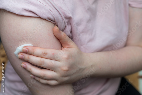 woman holds a fleece on her shoulder after being vaccinated against the coronavirus infection covid-19 during pandemic. photo