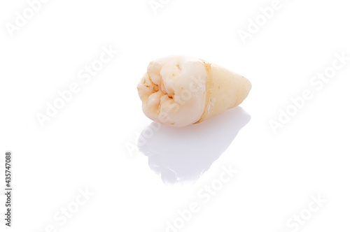 Wisdom tooth close-up white isolated