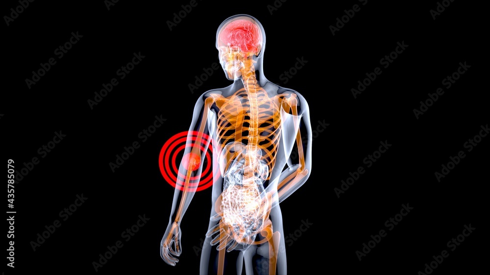 4K anatomy concept of an elbow pain 4K anatomy concept of an elbow pain