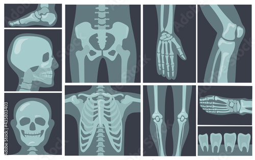 X-ray shots of human body. Cartoon vector illustration. X-rays of pelvis, chest, knees, feet in black background. Skeleton, X-ray, bone roentgen, medicine, health, research concept for banner design