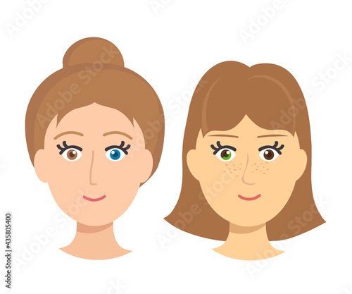 Woman with different eye color. Heterochromia.Cartoon. Vector illustration.