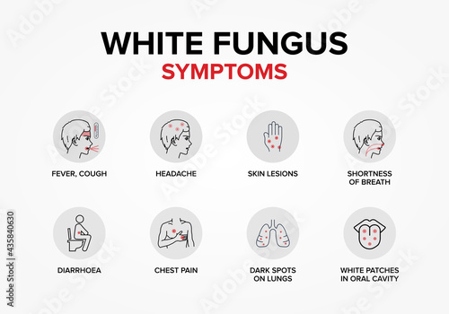 White Fungus or Fungal Disease Symptoms.