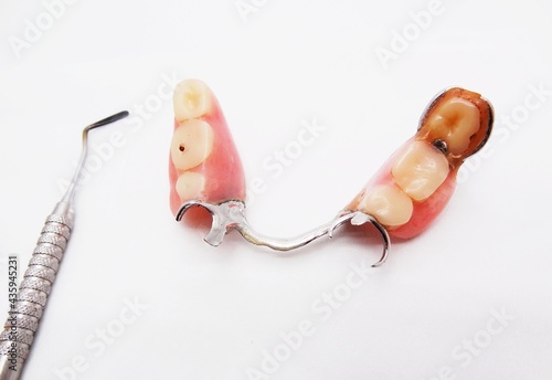 partial denture 