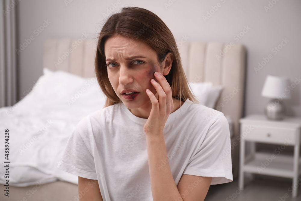 Woman with facial injuries in bedroom. Domestic violence victim