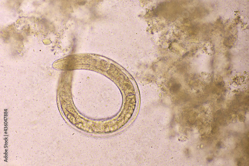 Strongyloides stercoralis or threadworm in human stool, analyze by microscope, original magnification 400x photo