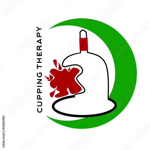 Traditional cupping therapy vector logo
