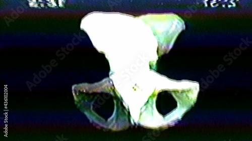 Analog Video Art Multicolored Abstract Shapes Signal Distortion