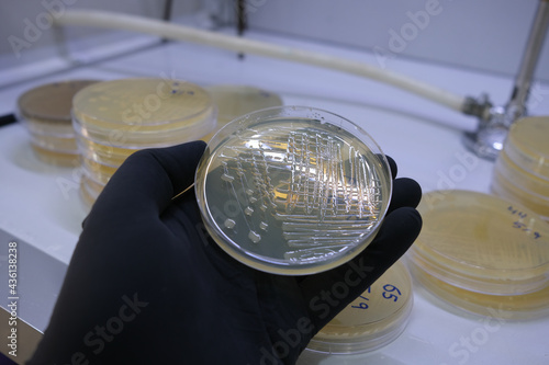 growth of bacterial colonies on agar media in a plastic plate photo