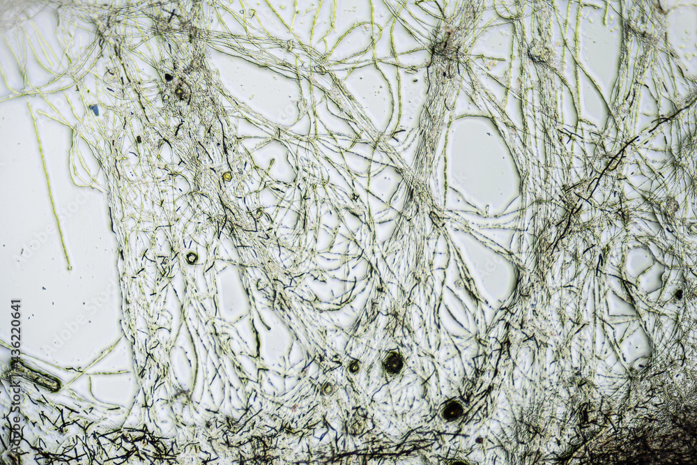 Foto de Kombucha tea macro close up under the light microscope ...