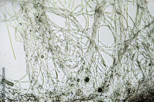 Kombucha tea macro close up under the light microscope, magnification of 100 times, microscope objective 10. Edge of tea jellyfish with threads