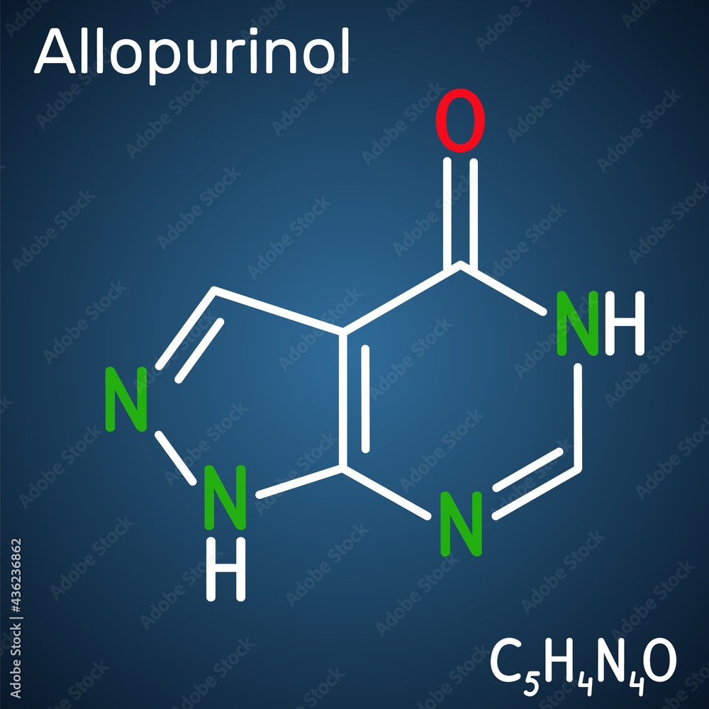 Allopurinol molecule. Drug is xanthine oxidase inhibitor, used to decrease high blood uric acid levels. Structural chemical formula on the dark blue background Allopurinol molecule. Drug is xanthine oxidase inhibitor, used to decrease high blood uric acid levels. Structural chemical formula on the dark blue background