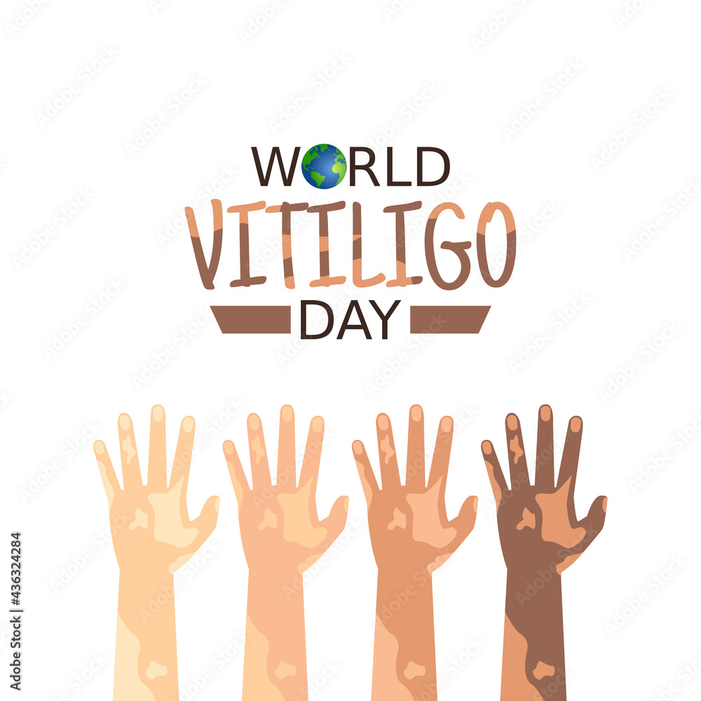 vector graphic of world vitiligo day good for world vitiligo day
