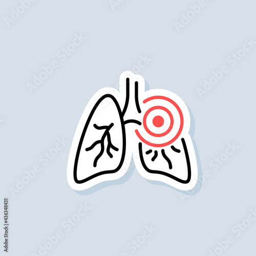 Lungs sticker. Pneumonia icon. Inflammatory in lungs. Asthma or tuberculosis. Vector on isolated background. EPS 10