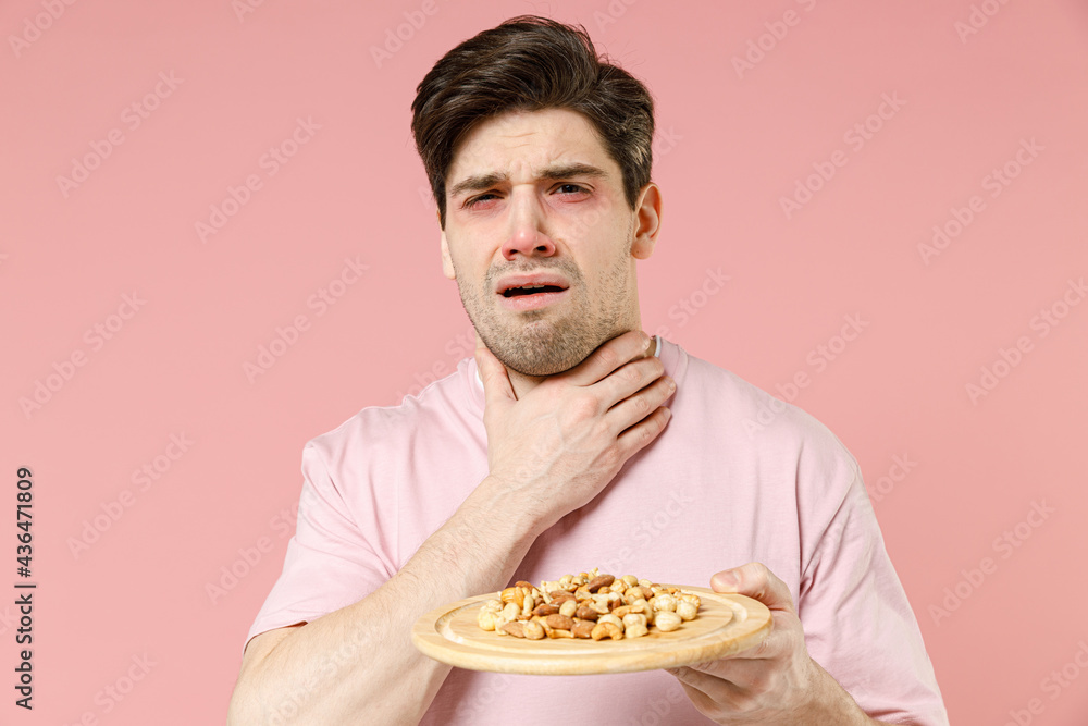 Sick unhealthy ill allergic man has red swelling watery eyes, runny