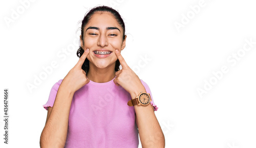 Hispanic teenager girl with dental braces wearing casual clothes smiling with open mouth, fingers pointing and forcing cheerful smile