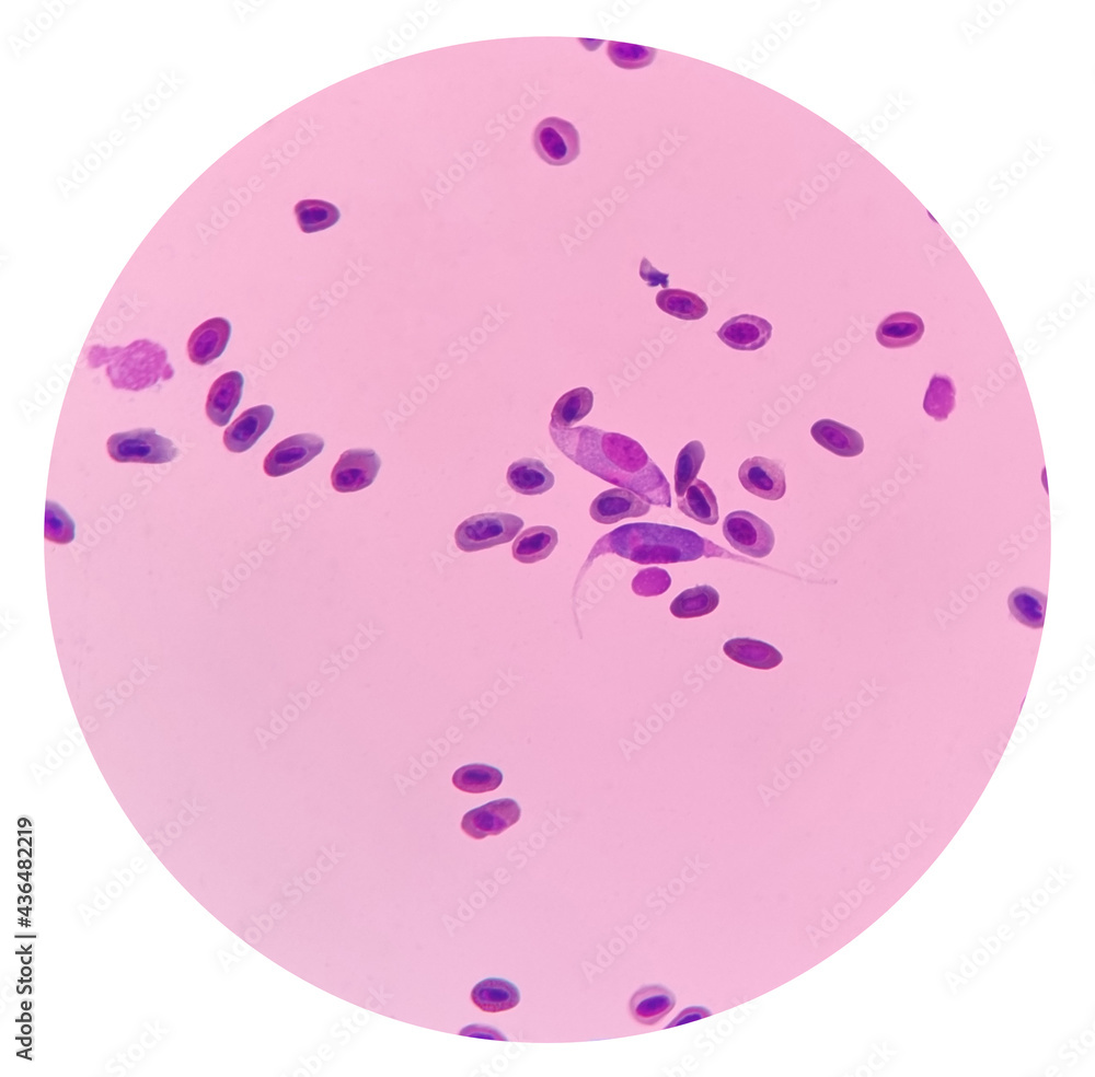 Leucocytozoon spp. in a stained blood smear from a chicken