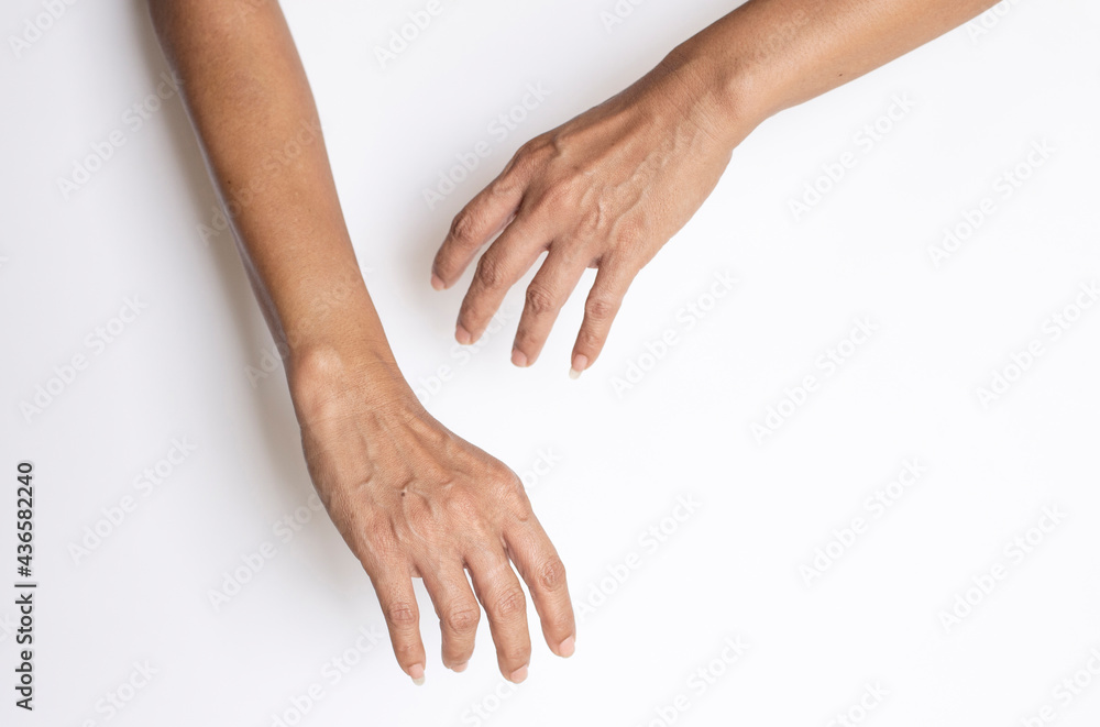 hand symptom. hand symptom.