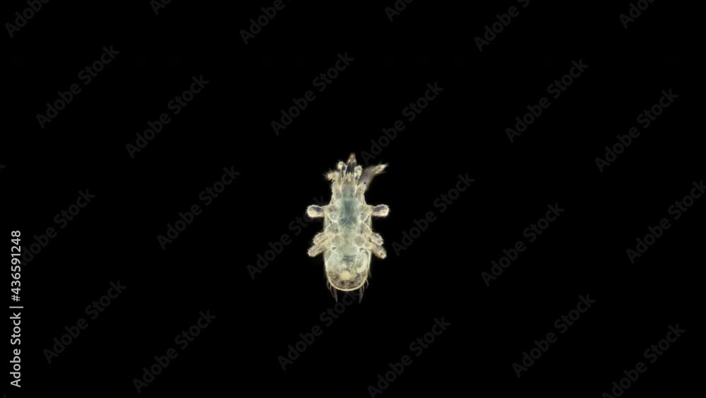 Predatory mite (acari) order Mesostigmata under a microscope, possibly of the Ascidae family. It feeds on larvae, insect eggs ... Predatory mite (acari) order Mesostigmata under a microscope, possibly of the Ascidae family. It feeds on larvae, insect eggs ...