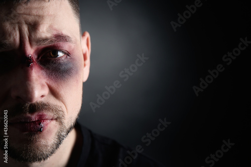 Closeup view of man with facial injuries on dark background, space for text. Domestic violence victim