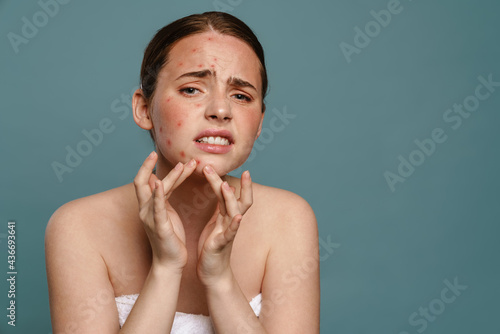 Ginger young woman wearing towel squeezing pimple on her face photo