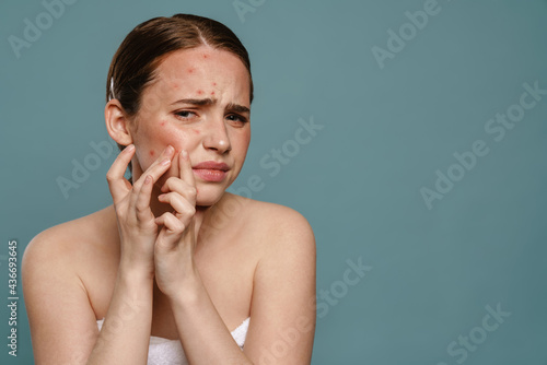 Ginger young woman wearing towel squeezing pimple on her face photo