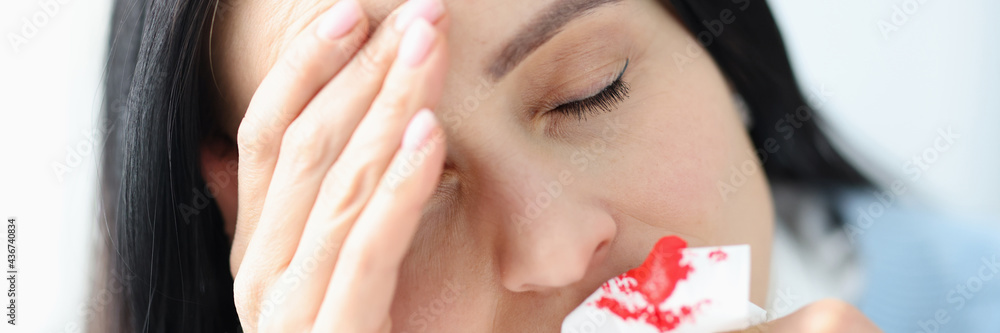 Woman with headache holding bloody napkin near nose
