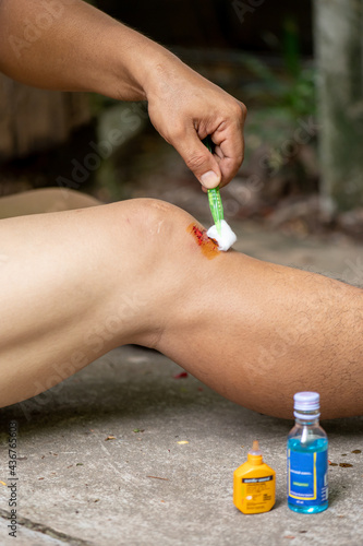 The leg was injured from a fresh wound that was oozing with blood. See the injured doctor.