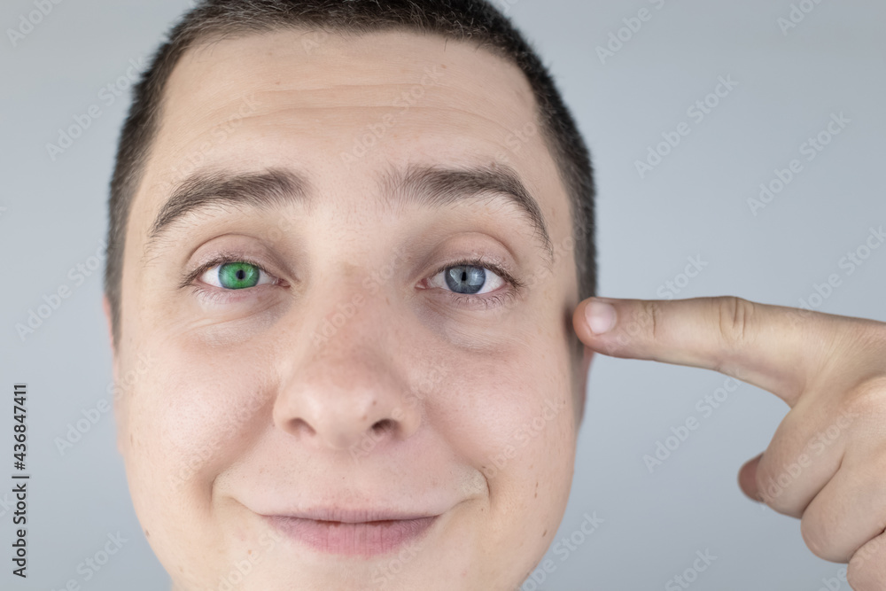 A man with different color eyes looks into the frame. The right eye is
