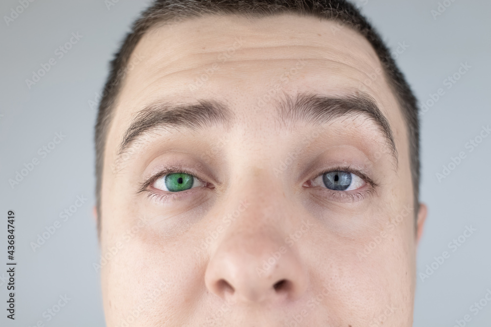 A man with different color eyes looks into the frame. The right eye is blue and the left is green. Heterochromia. Gene mutation. Multi-colored eyes.