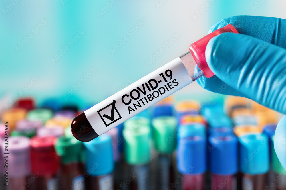 Lab Technician with an antibody blood tube from a cured Covid-19 patient. Doctor with a blood tube with antibodies for infectious disease Coronavirus covid-19 virus or Sars-Cov-2
