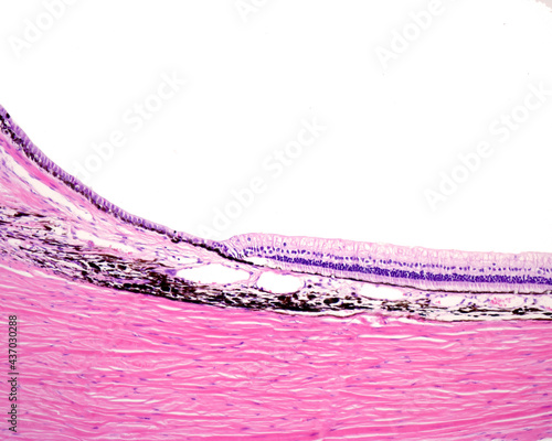 Limit retina-ciliary body photo