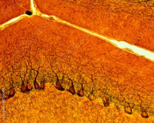 Cerebellum. Purkinje cells photo