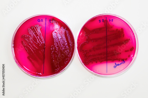 E coli bacteria grow characteristics on selective media photo