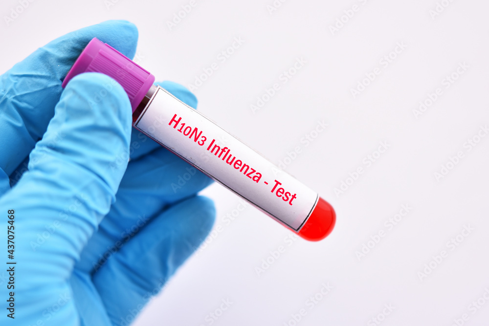 Fototapeta premium H10N3 bird flu test, blood sample tube for influenza A virus subtype H10N3 test