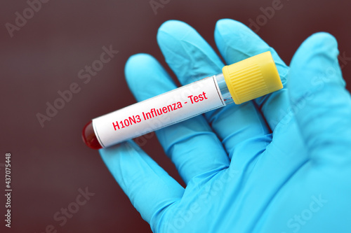 H10N3 bird flu test, blood sample tube for influenza A virus subtype H10N3 test photo