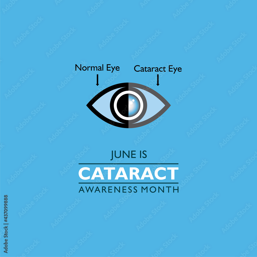 Cataract Awareness Month observed in June, It is a dense, cloudy area that forms in the lens of the eye. Cataract Awareness Month observed in June, It is a dense, cloudy area that forms in the lens of the eye.