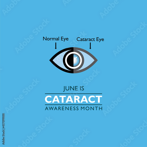 Cataract Awareness Month observed in June, It is a dense, cloudy area that forms in the lens of the eye.