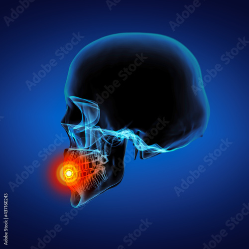 3D rendering of skull