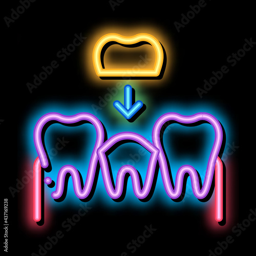 Stomatology Tooth Crown neon light sign vector. Glowing bright icon transparent symbol illustration
