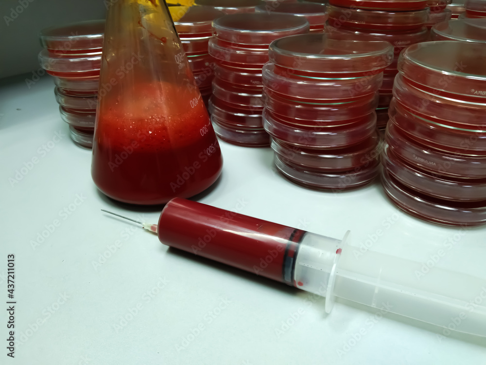 Conical flask with syringe fresh sheep blood and agar medium to making