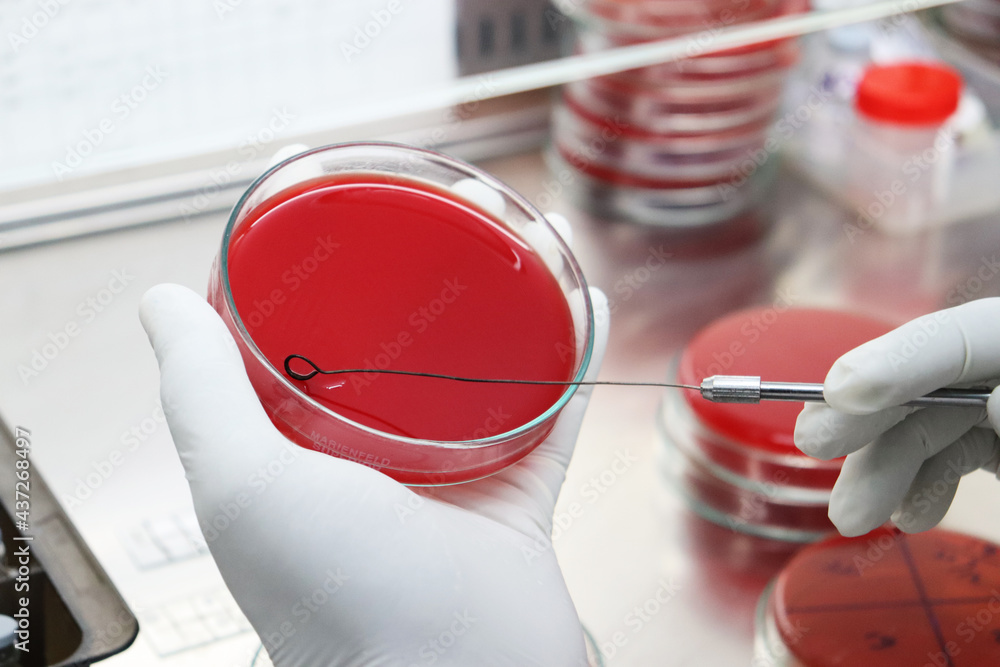 micro organisms identification in medical laboratory