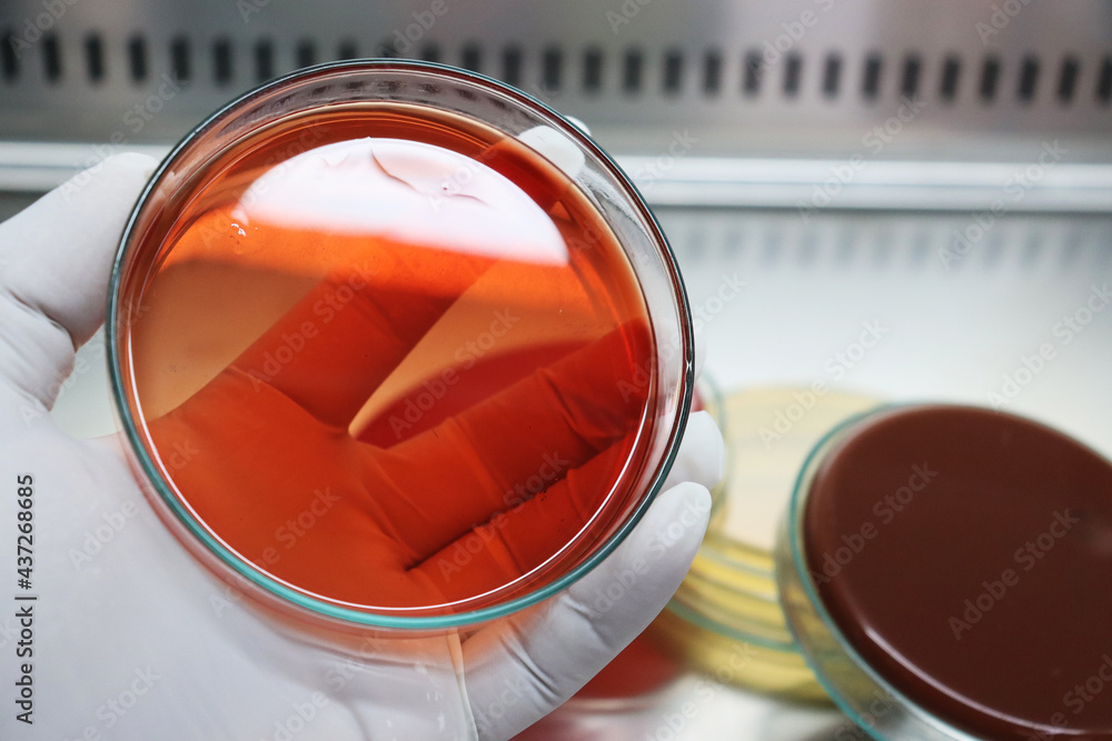 blood culture media for identification Stock Photo