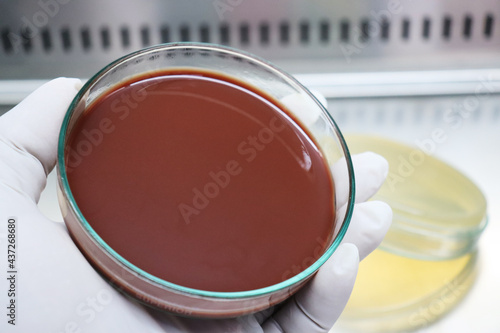фотографія chocolate blood agar for microorganisms identification