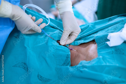 Εκτύπωση καμβά anesthetist setting central venous catheter to patient before open heart surgery