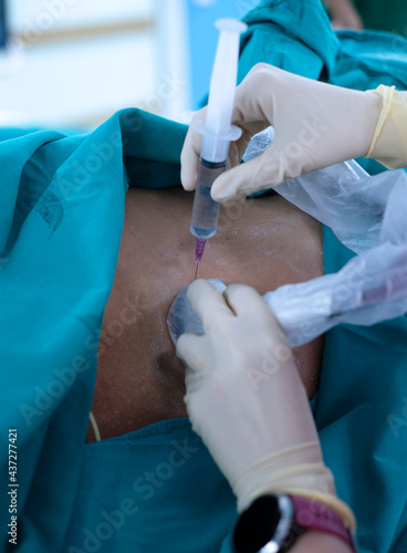 Anesthetist press ultrasound probe and injection more medication on the patient’s back for release pain in Epidural analgesia or Epidural nerve block procedure.
