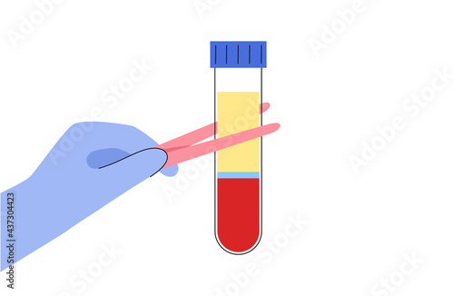 Platelet rich plasma concept